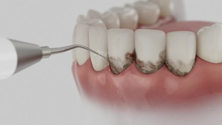 Trusted Tooth Extraction service in Wheaton, MD - Dentist Open Now